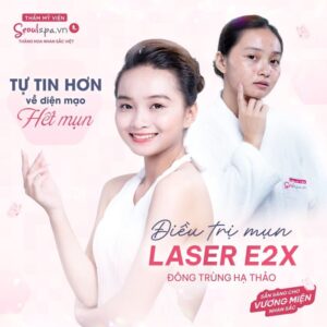 Trị mụn dứt điểm ở Thẩm mỹ viện SeoulSpa.Vn Quận Gò Vấp với công nghệ laser E2X