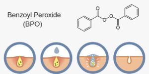 Benzoyl peroxide là chất có khả năng điều trị mụn hiệu quả được giới chuyên gia tin dùng hiện nay