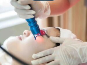 Quy trình điều trị mụn bằng nano skin tuân thủ các tiêu chuẩn y khoa