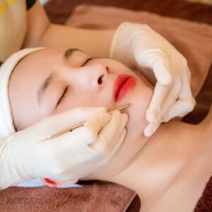 Evie Clinic & Spa là địa chỉ đáng tin cậy chuyên sâu cho vấn đề da mụn