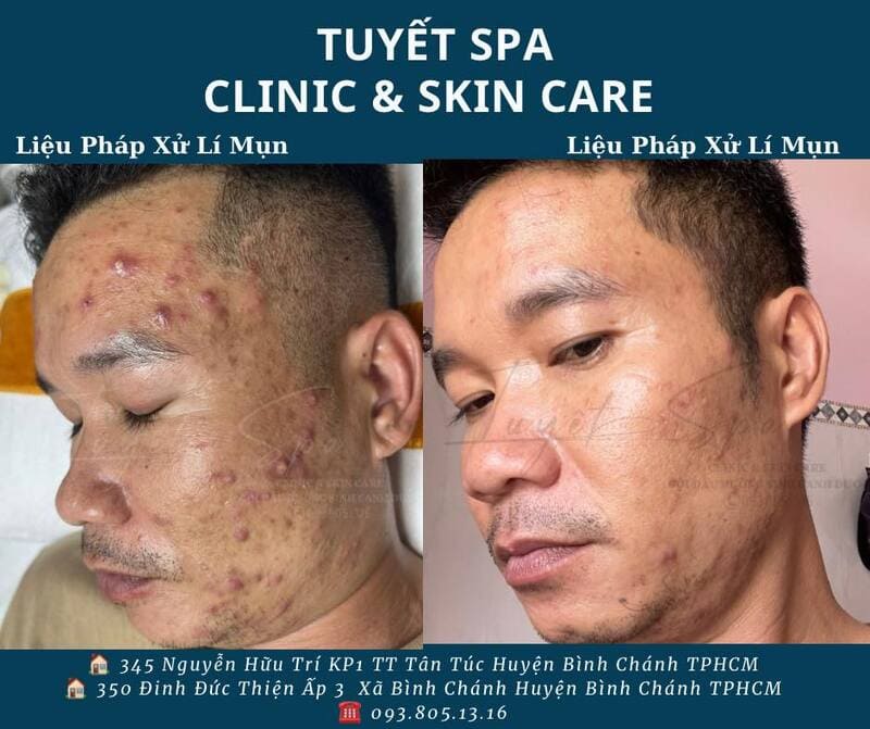 Tuyết Spa Clinic & Skin Care được nhiều người tin tưởng