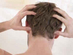 Có nhiều nguyên nhân khiến da đầu bị nổi mụn