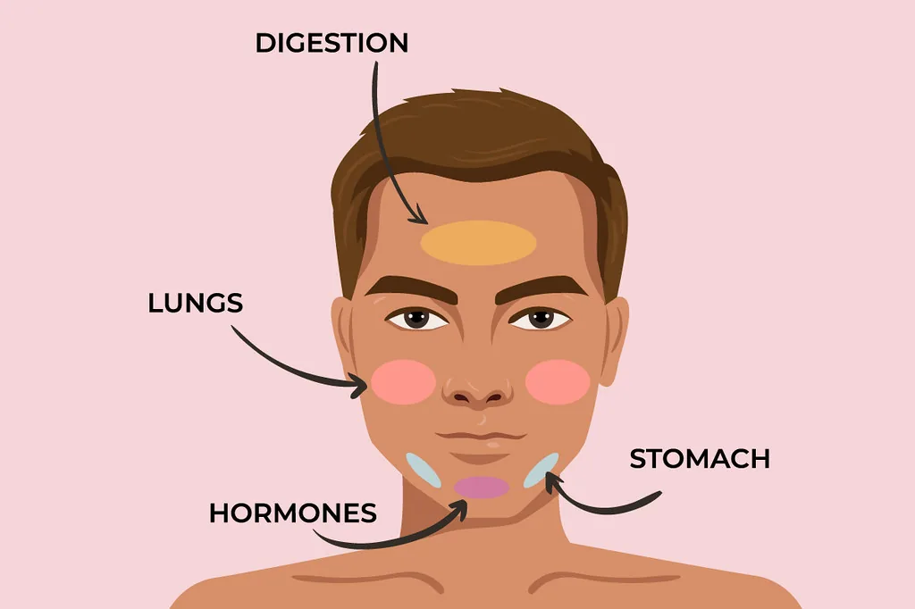 hormonal acne chin treatment