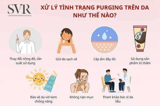 Cách chăm sóc da khi purging như thế nào?