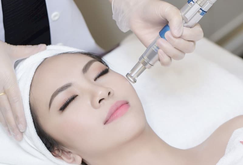                               Bắn tia laser trị tàn nhang vô cùng hiệu quả