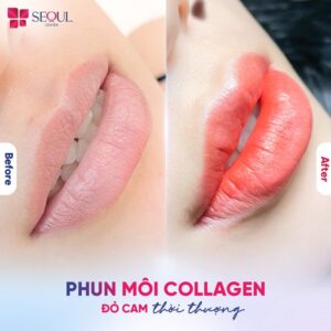 Thẩm mỹ viện SeoulSpa.Vn – Địa chỉ phun xăm thẩm mỹ uy tín và chất lượng ở Cầu Giấy