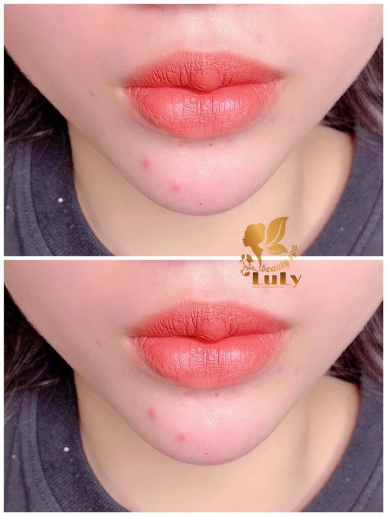 Luly Beauty Spa & Clinic chuyên phun xăm thẩm mỹ tại Châu Đốc