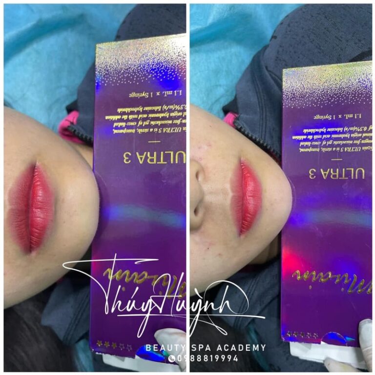 Đôi môi đều màu và căng mọng sau khi thực hiện tại BT Beauty Spa