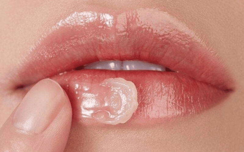 Phun môi collagen hồi phục nhanh trong 5-7 ngày