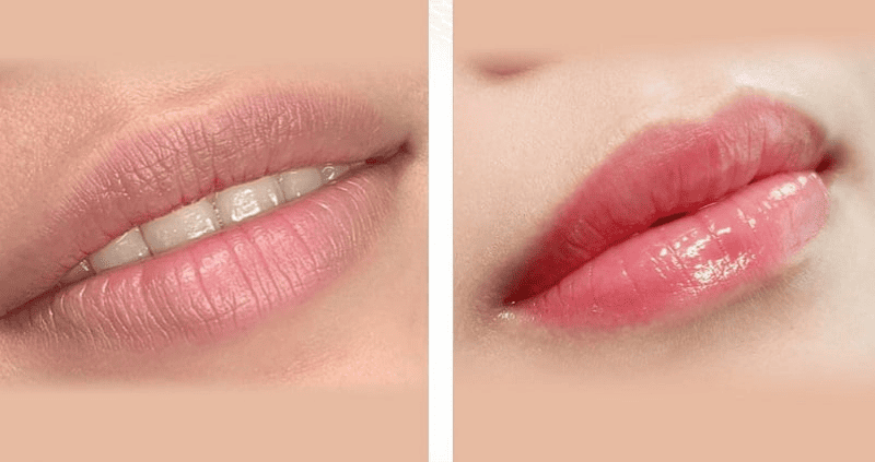 Các kiểu phun môi: collagen, pha lê, xí muội