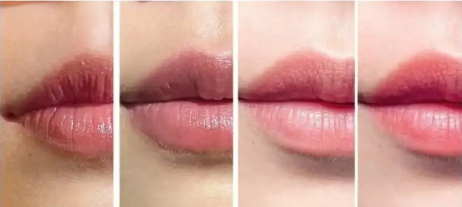 Thời gian cụ thể phụ thuộc vào tốc độ hồi phục cá nhân của bạn.