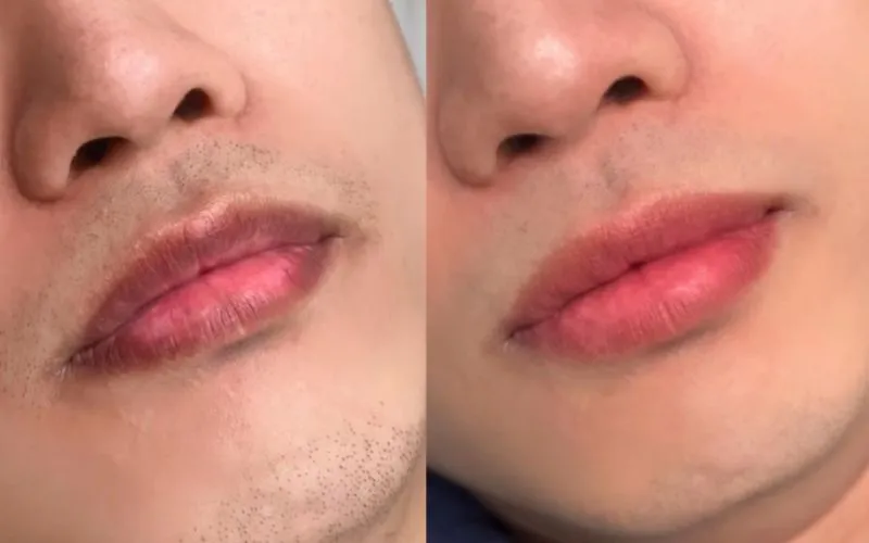 Phun môi nam (còn gọi là xăm môi hoặc dệt môi) là kỹ thuật trang điểm vĩnh viễn