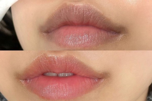 Sau tuổi 30, da mất collagen dần dần, môi trở nên mỏng, khô, và dễ bong tróc.