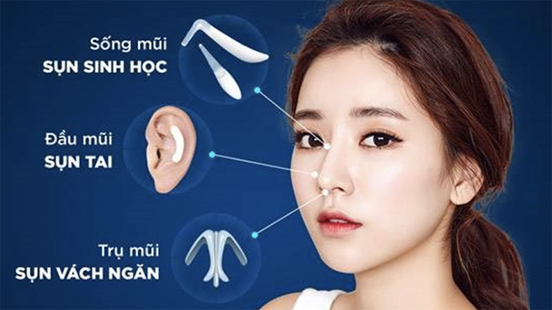 Ba loại sụn tự thân là sụn tai, sụn vách ngăn và sụn sườn
