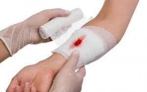 Bị vết thương hở nên kiêng ăn ít nhất 1 tuần