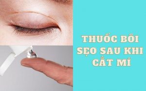 5 thuốc bôi sẹo sau khi cắt mí hiệu quả