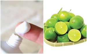 Kem đánh răng và chanh gia tăng hiệu quả trị sẹo thâm