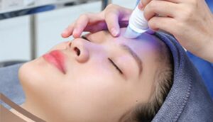 Glamour Beauté áp dụng các công nghệ trị sẹo tiên tiến hàng đầu