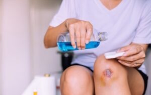 Vết thương chảy nước vàng không lành có thể do vệ sinh không đúng cách