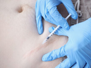 Tiêm sẹo lồi là phương pháp xóa sẹo đơn giản, được bác sĩ da liễu thực hiện