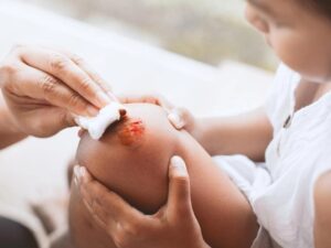 Vết thương bị nhiễm trùng là một tình trạng do tác nhân bên ngoài gây ra