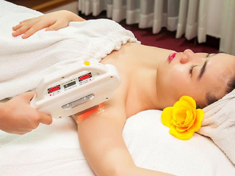 Hình 1 - Triệt lông bằng Diode Laser cho hiệu quả lên đến 99%
