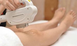                               Mỗi lần triệt lông cách nhau bao lâu