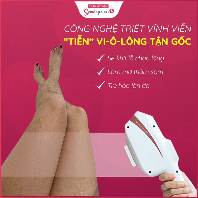 mua máy triệt lông hay đi spa Kỹ thuật viên tại spa giúp triệt lông từ A-Z, với hiệu quả làm đẹp cao