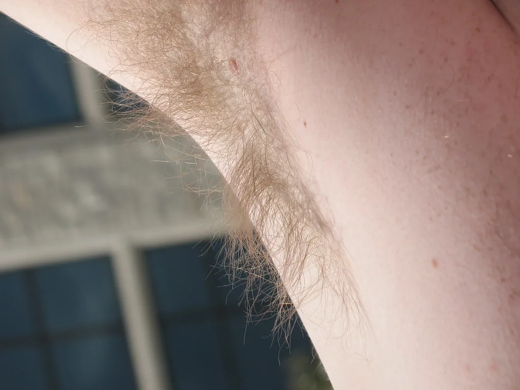 Underarm hair removal body odor