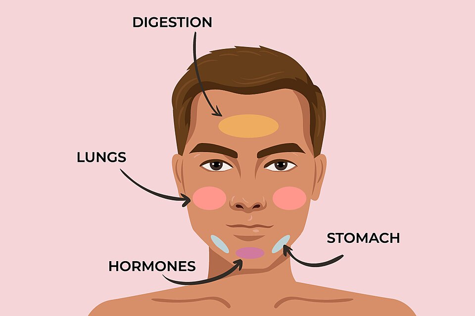 Nếu vùng cần triệt đang có nhiều tổn thương mụn viêm, nên đánh giá tình trạng da trước khi thực hiện laser.