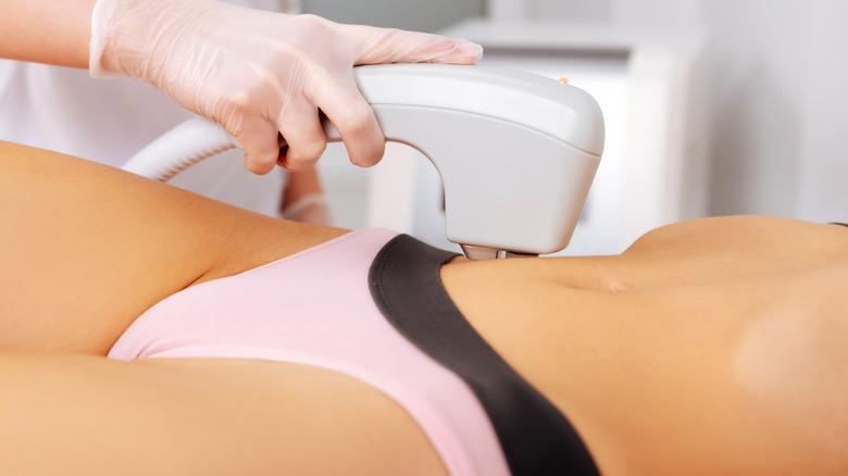 Kết quả trước và sau triệt lông cắt tỉa ra sao?