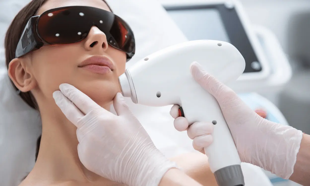 Triệt lông mặt bằng laser cần sử dụng thiết bị và thông số phù hợp với màu da, màu lông của từng người.