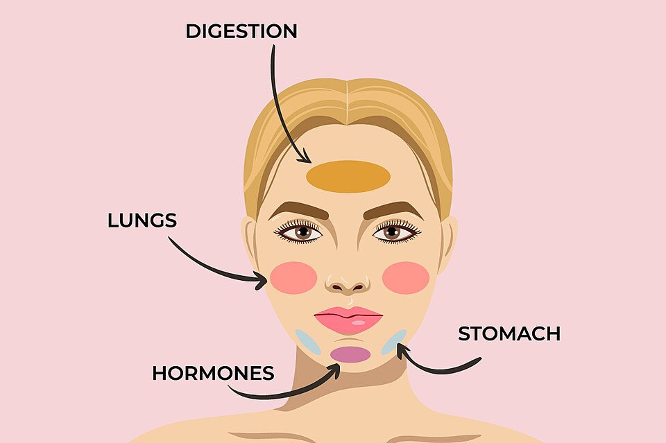 Người có làn da vốn dễ nổi mụn nên được đánh giá tình trạng da trước khi triệt lông trên vùng mặt.