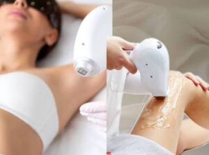 5 lợi ích chính của triệt lông toàn thân là gì?
