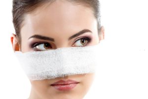 Sau khi nâng mũi thường có hiện tượng sưng bầm