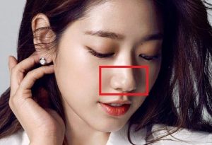 Mũi chẻ chưa phải là dáng mũi hoàn hảo mà chị em mong muốn