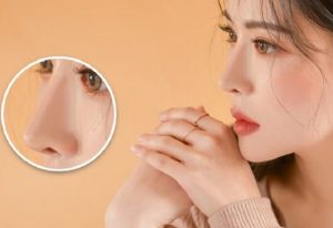 Sau 18 tuổi, mũi còn phát triển thêm được không?