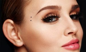 Nốt ruồi ở song song tại thái dương là một vị trí tài lộc, may mắn