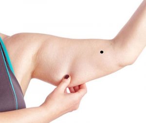 Những người có nốt ruồi nằm phía trong khuỷu tay phải thường giàu có