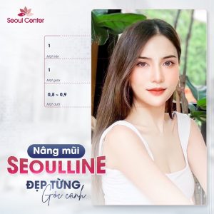 Hình ảnh nâng mũi bằng công nghệ Mega Seoul Line