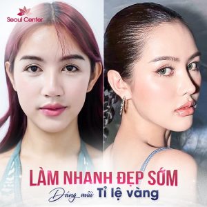 Chuyên gia giải đáp vấn đề nên nâng mũi cấu trúc hay bọc sụn