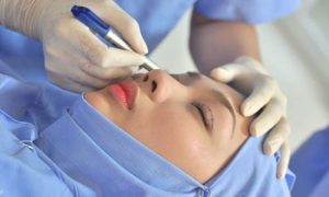 Thực hiện ở cơ sở nhấn mí uy tín sẽ có mức giá cao hơn