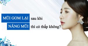 Tình trạng nâng mũi gom lại không làm mũi thấp đi mà góp phần làm cho dáng mũi cân đối, hài hòa với khuôn mặt