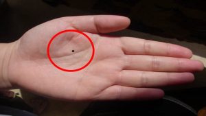 Ý nghĩa nốt ruồi trong lòng bàn tay ở nam và nữ