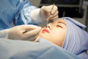 Nâng mũi nội soi giúp bác sĩ quan sát tốt hơn và hạn chế tối đa các rủi ro