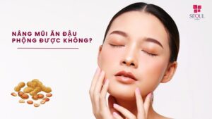 Người mới nâng mũi không nên ăn đậu phộng trong 2 tuần đầu