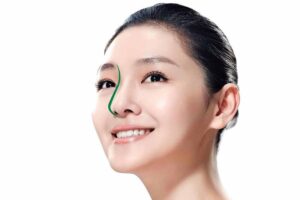 Nâng mũi S Line duy trì được tuổi thọ lâu dài đến 20 năm hoặc vĩnh viễn