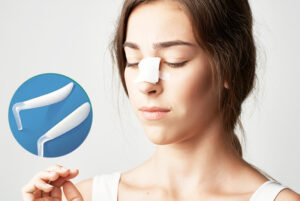 Sử dụng sụn kém chất lượng khiến mũi bị viêm nhiễm nên cần tháo sụn