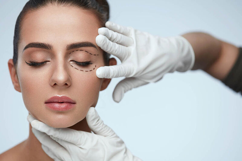 Vết thương cắt mí mắt sau 20 ngày đã dần hồi phục