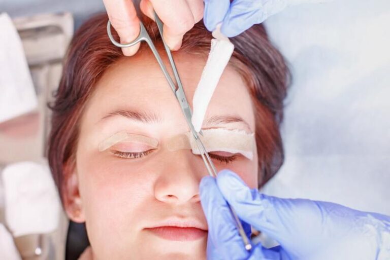 Sau 20 ngày mí mắt vẫn sưng là tình trạng bình thường có thể xảy ra ở một số người